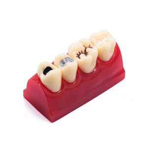Read more about the article How often should teeth sealants be checked?
