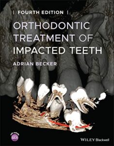 Read more about the article Can Orthodontic Treatment Help with Jaw Alignment Problems?